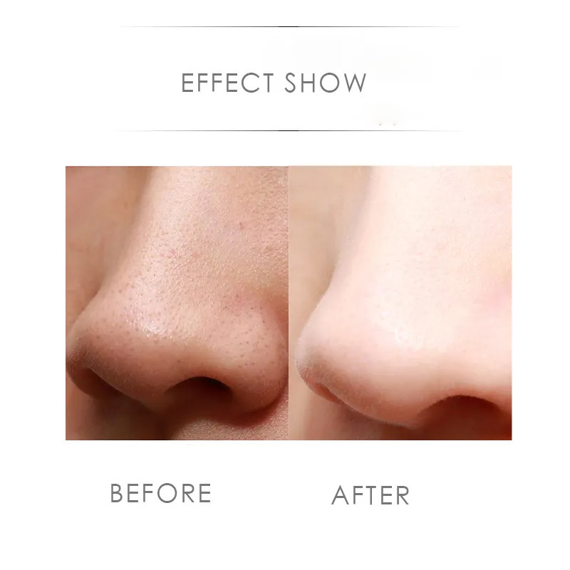 اتوی صورت التراسونیک مدل CT007