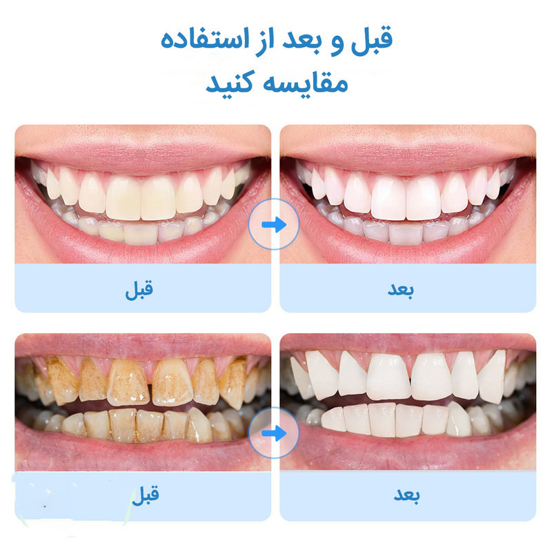 دستگاه شست و شو و جرم گیر دندان برقی مدل IPX7