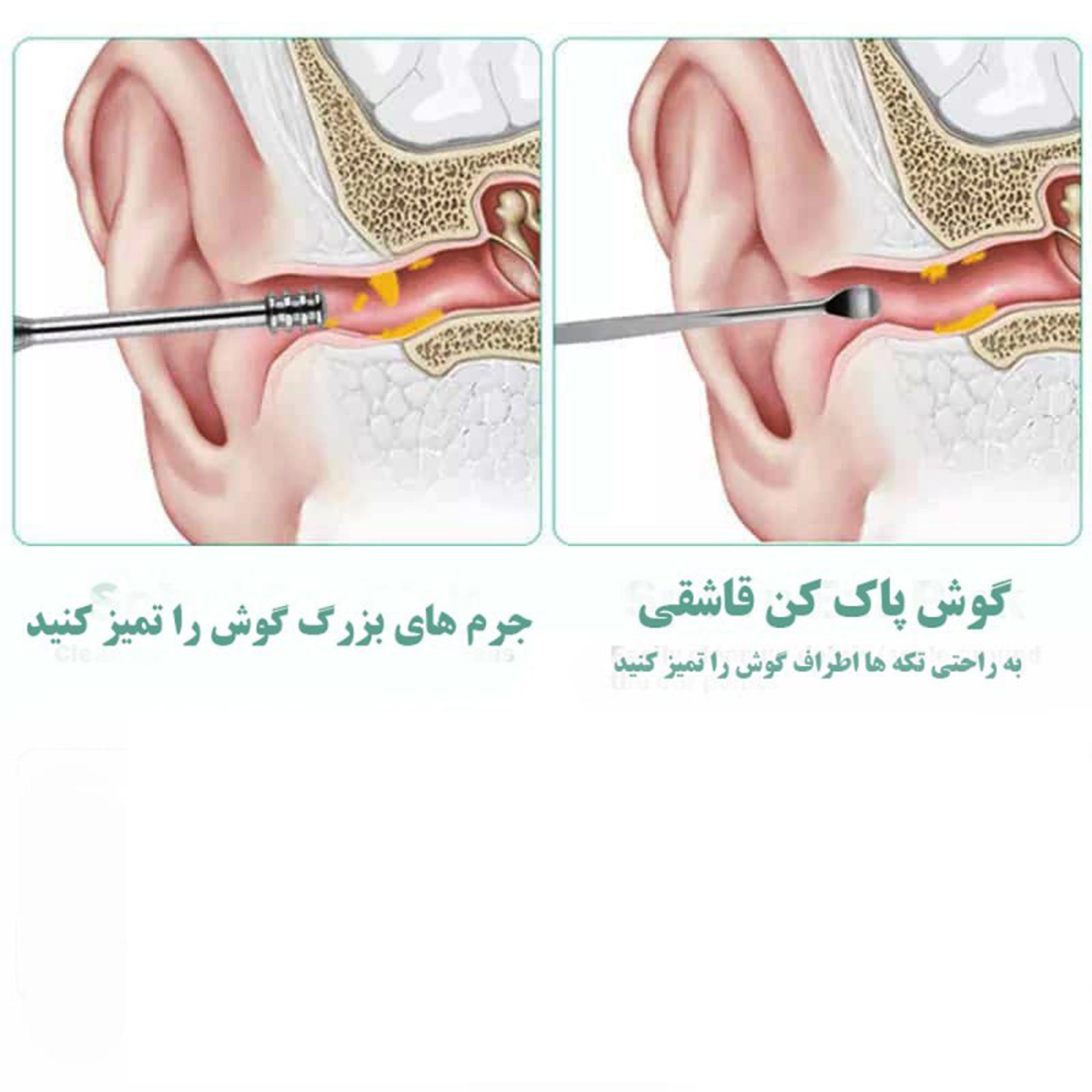 مجموعه نظافت گوش مدل M1 بسته 6 عددی -  - 5