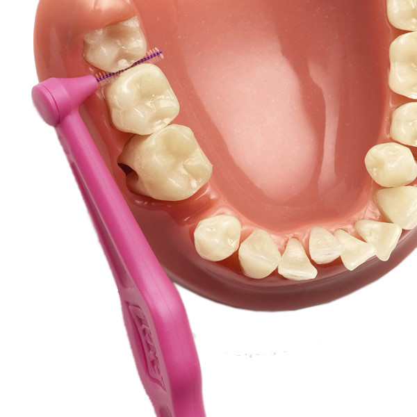 مسواک بین دندانی تهپه مدل Angle سایز 0 بسته 6 عددی مسواک بین دندانی تهپه مدل Angle سایز 0 بسته 6 عددی