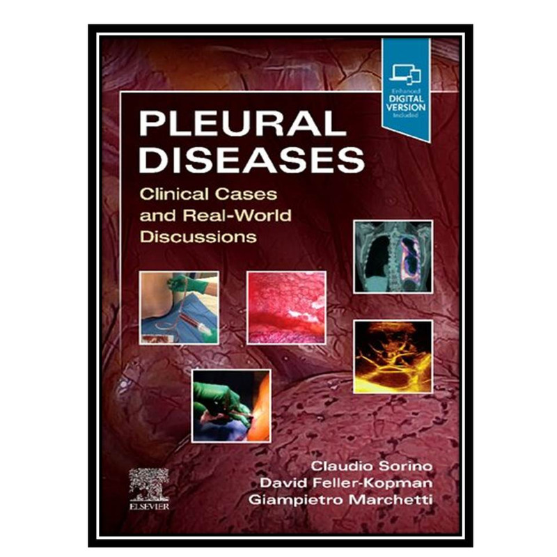 کتاب Pleural Diseases: Clinical Cases and Real-World Discussions اثر جمعی ازنویسندگان انتشارات مؤلفین طلایی