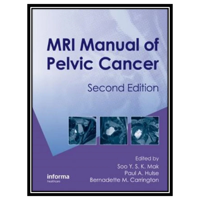 کتاب MRI Manual of Pelvic Cancer, Second Edition اثر جمعی از نویسندگان انتشارات مؤلفین طلایی