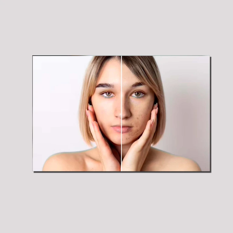 تابلو شاسی مدل پوست و پاکسازی پوست کد 119