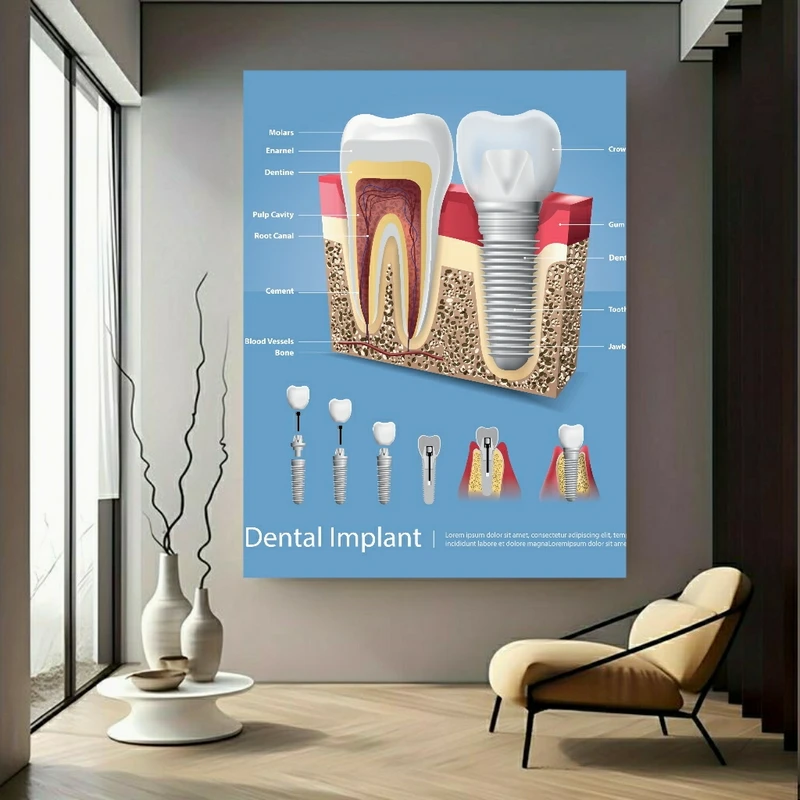 تابلو بوم طرح ایمپلنت دندان کد FP105081