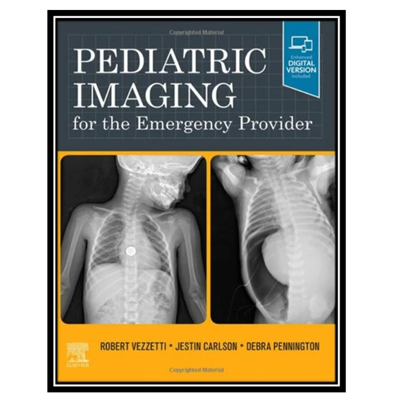 کتاب Pediatric Imaging for the Emergency Provider اثر جمعی ازنویسندگان انتشارات مؤلفین طلایی