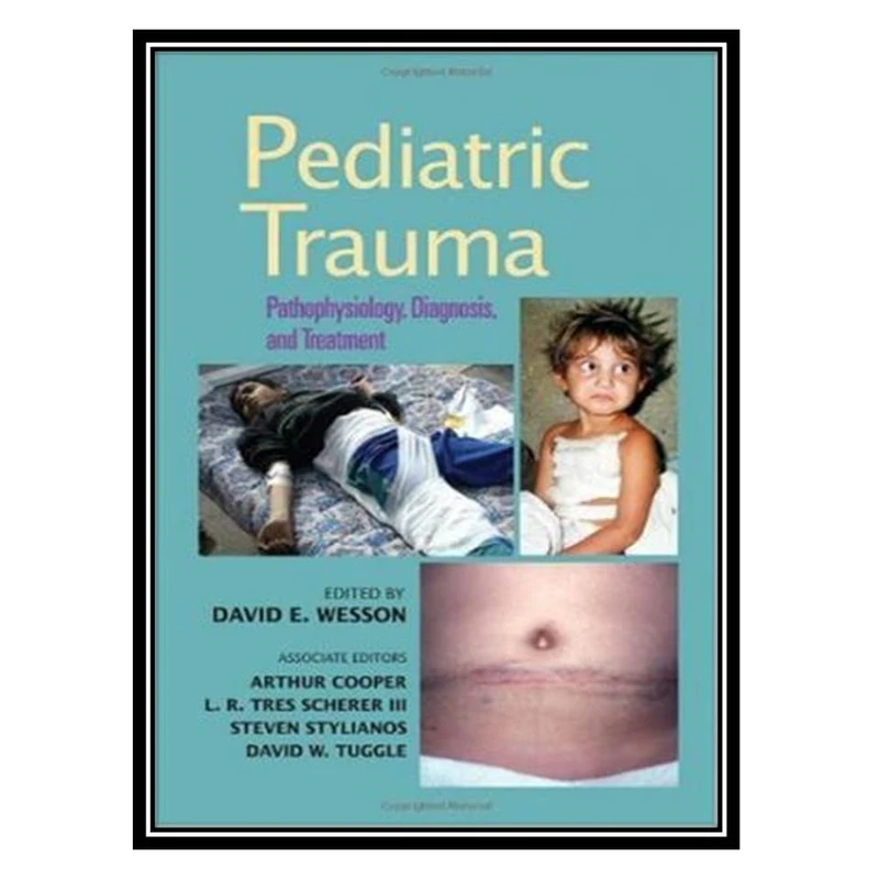 کتاب Pediatric Trauma اثر جمعی از نویسندگان انتشارات مؤلفین طلایی