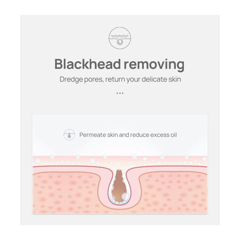 ماسک بینی لنبنا مدل Aloe Deep Cleaning وزن 5 گرم مجموعه 5 عددی