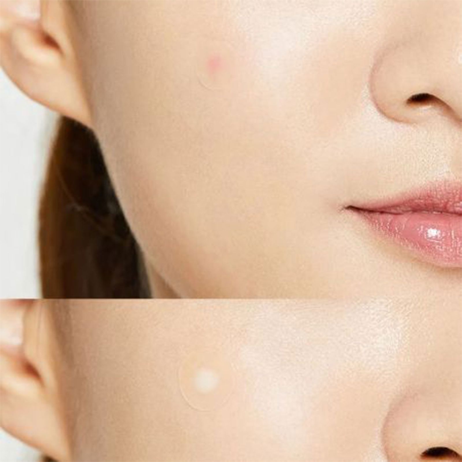 چسب ضد جوش پنرول مدل PRD Acne Cover Patch 360 بسته 36 عددی -  - 16