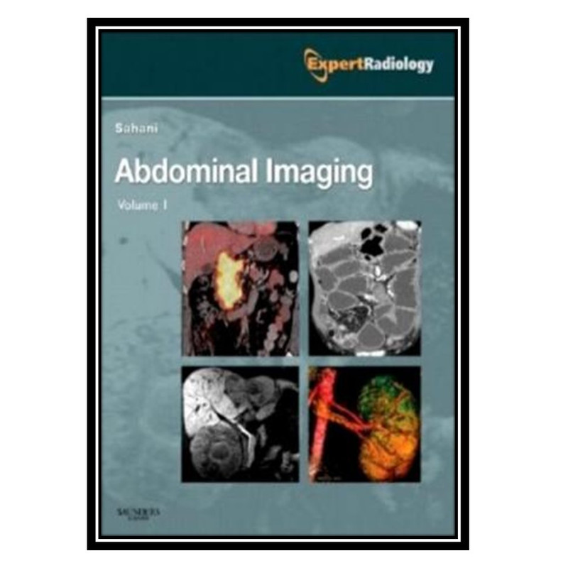 قیمت و خرید کتاب Abdominal Imaging اثر Dushyant V. Sahani and Anthony E ...