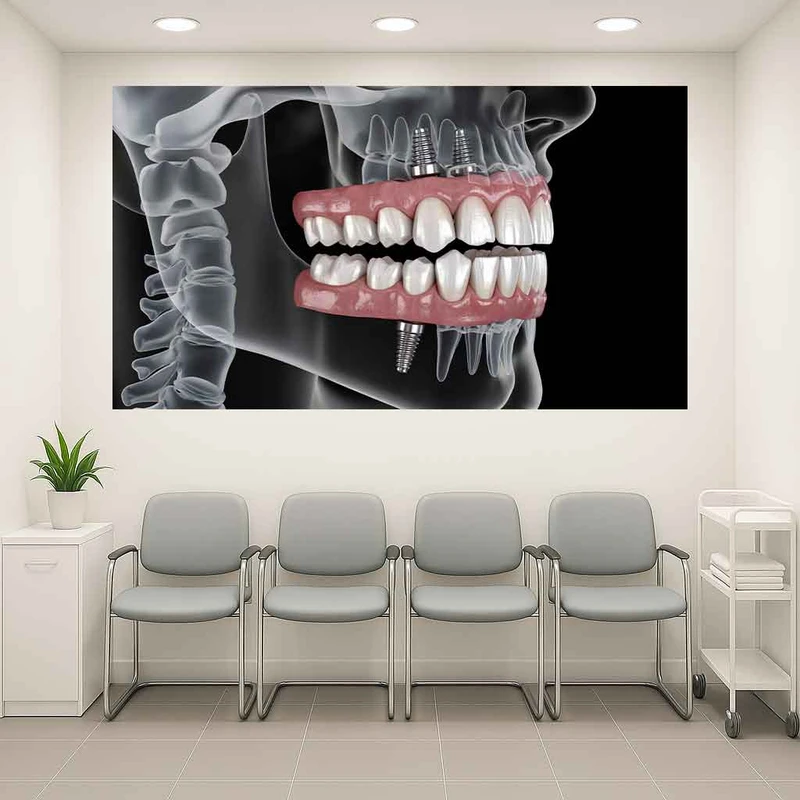 پوستر پارچه ای طرح مخمل  دندانپزشکی مدل ایمپلنت دندان کد AR3061403