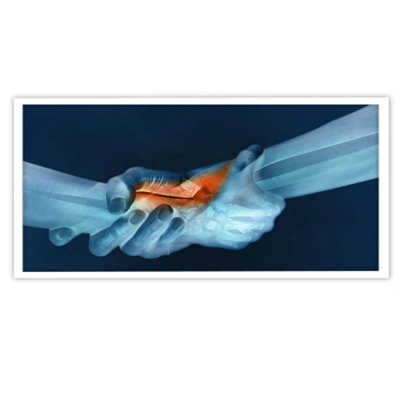 تابلو بکلیت طرح عکس رادیوگرافی دست مدل W-10608