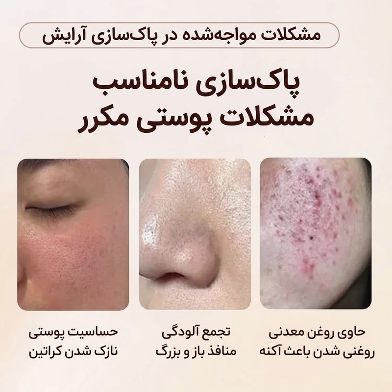 روغن پاک‌کننده آرایش صورت بیکی آپ مدل مسافرتی مناسب انواع پوست حجم ۲ میلی لیتر بسته ۷ عددی