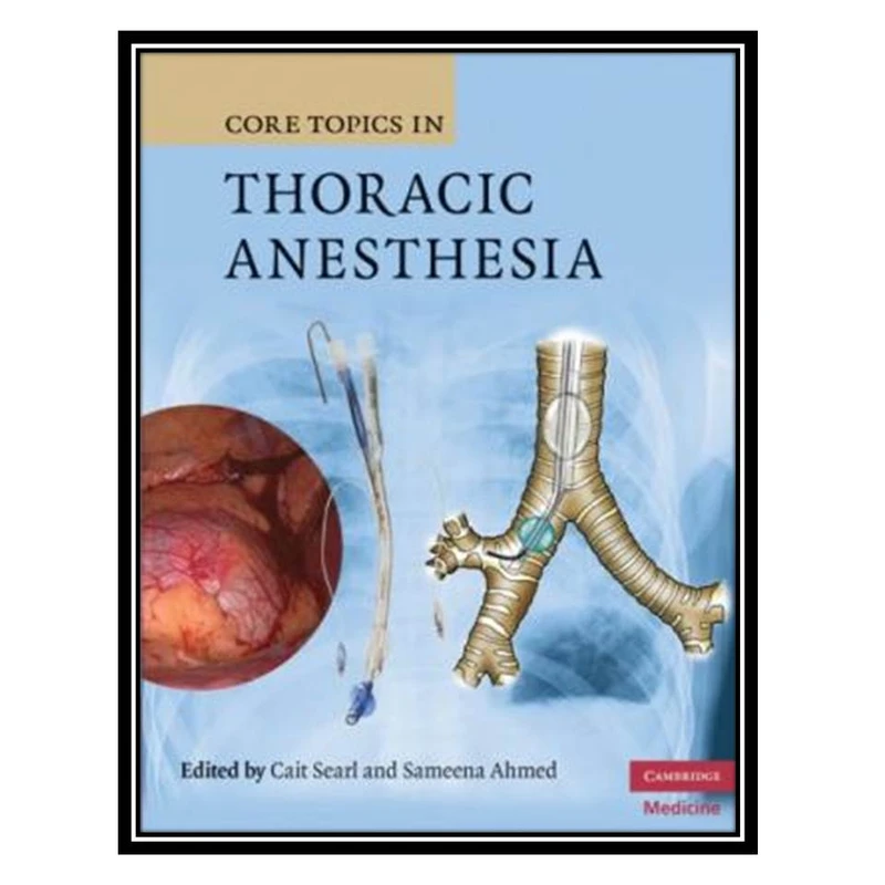 کتاب Core Topics in Thoracic Anesthesia اثر جمعی از نویسندگان انتشارات مولفین طلایی 