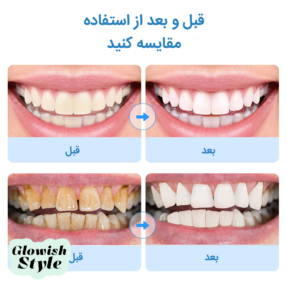 مسواک برقی گلویش استایل مدل 8in1 -  - 12