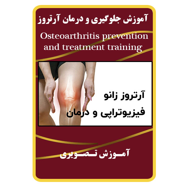 ویدئو آموزش جلوگیری و درمان آرتروز نشر مبتکران