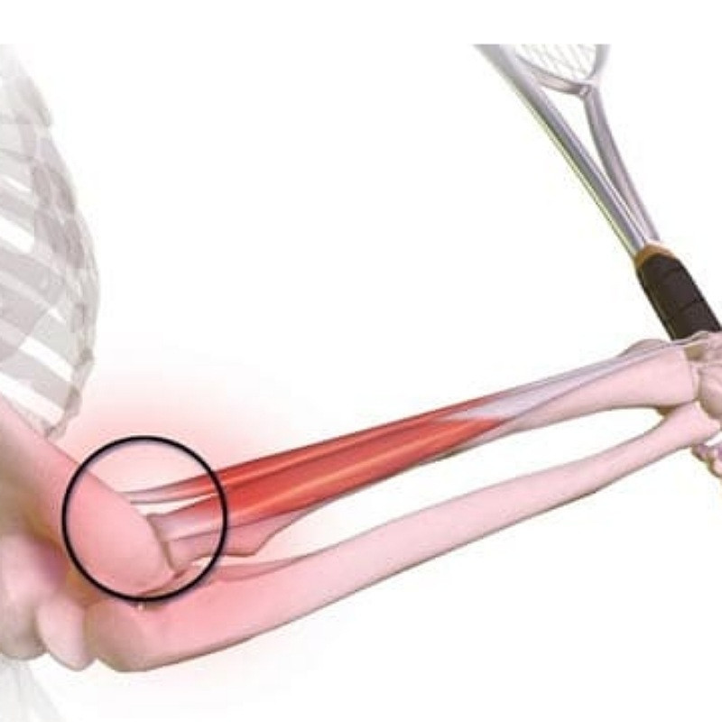 تنیس البو مدل TNE-S2022