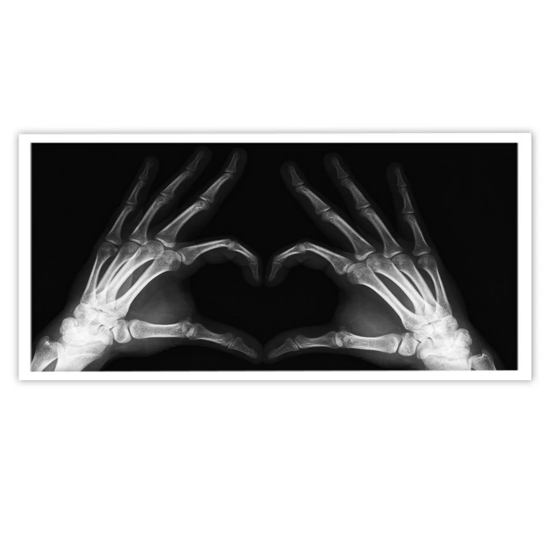 تابلو بکلیت طرح عکس رادیو گرافی دست مدل W-10609