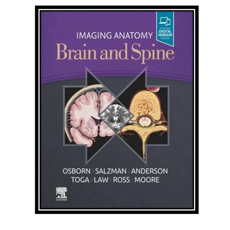 تاب Imaging Anatomy Brain and Spine اثر جمعی از نویسندگان انتشارات مؤلفین طلایی
