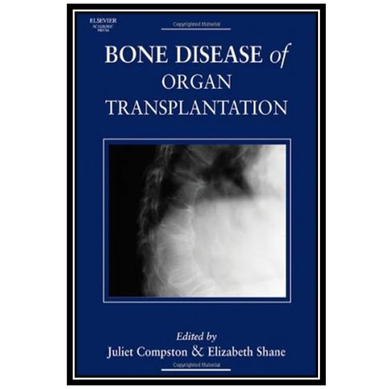 کتاب Bone Disease of Organ Transplantation اثر Juliet Compston and Elizabeth Shane انتشارات مؤلفین طلایی