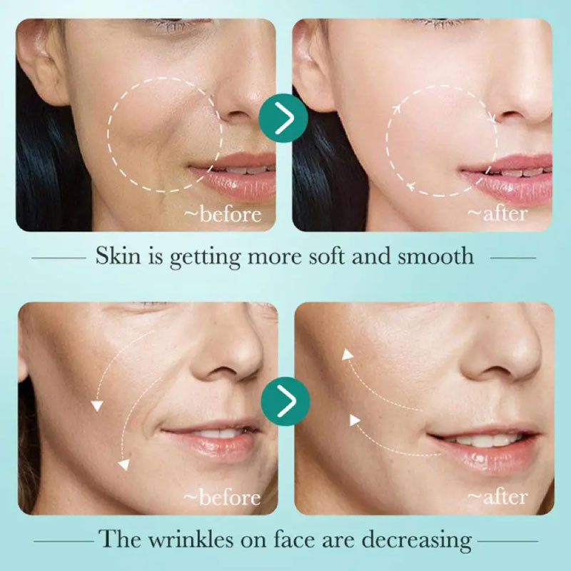 سرم پوست بایو آکوا مدل هیالورنیک اسید حجم 30 میلی لیتر