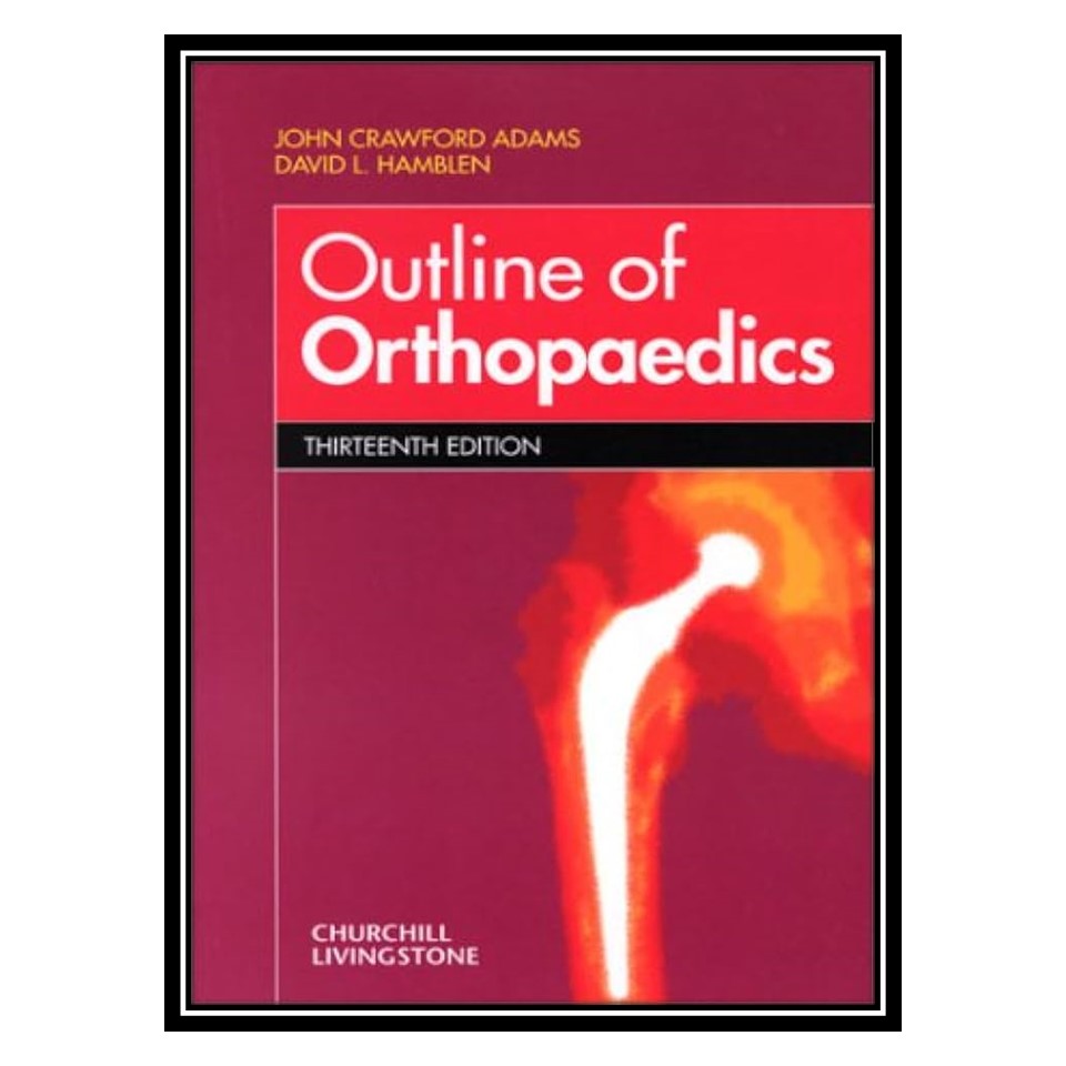 کتاب Outline of Orthopaedics اثر جمعی از نویسندگان انتشارات مؤلفین طلایی