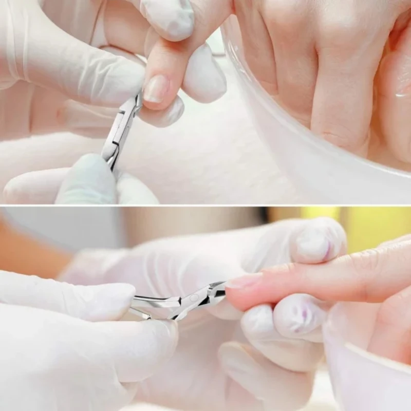 عکس شماره 4 : گوشت گیر ناخن مدل biuthy vtala