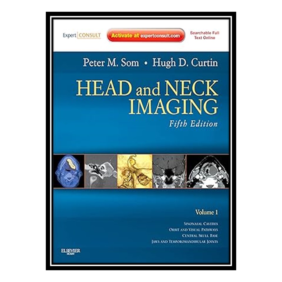 کتاب Head and Neck Imaging اثر Peter M , Hugh D Curtin انتشارات مؤلفین طلایی
