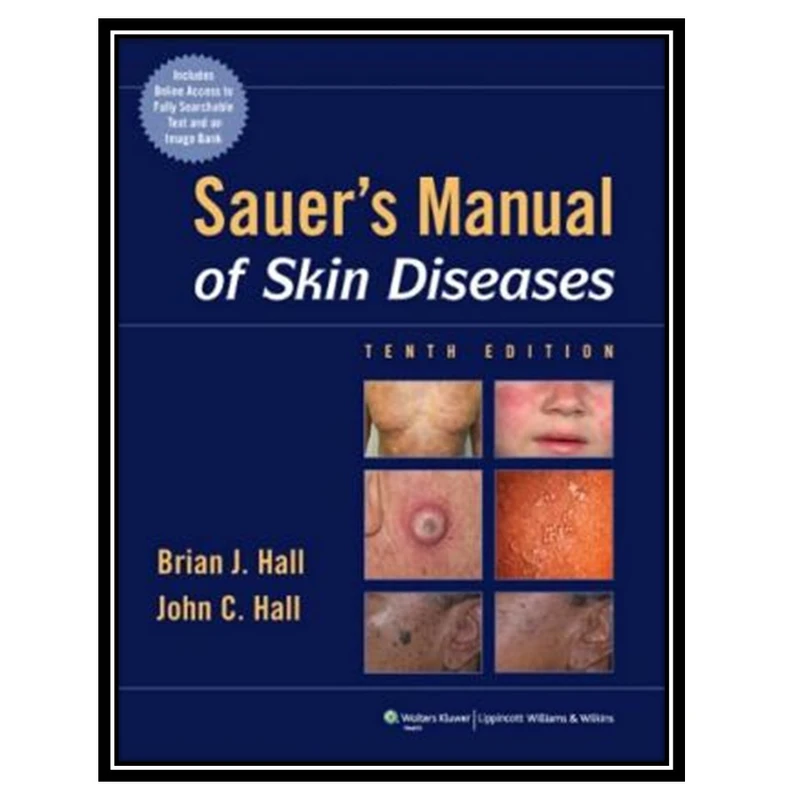 کتاب Sauer’s Manual of Skin Diseases اثر Brian J. Hall and John C. Hall انتشارات مؤلفین طلایی