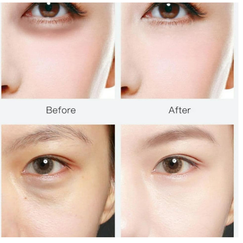 ماسک زیر چشم ونزن مدل Ruby Collagen حجم 80 میلی لیتر بسته 60 عددی