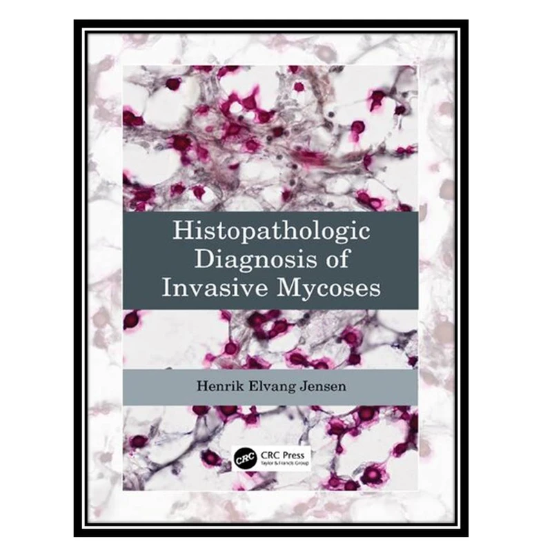 کتاب Histopathologic Diagnosis of Invasive Mycoses اثر Henrik Elvang Jensen انتشارات مؤلفین طلایی