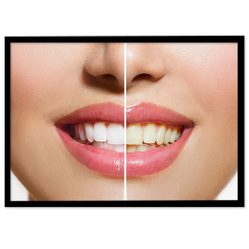 تابلو نوری بکلیت طرح دندان پزشکی و لبخند مدل B-S690