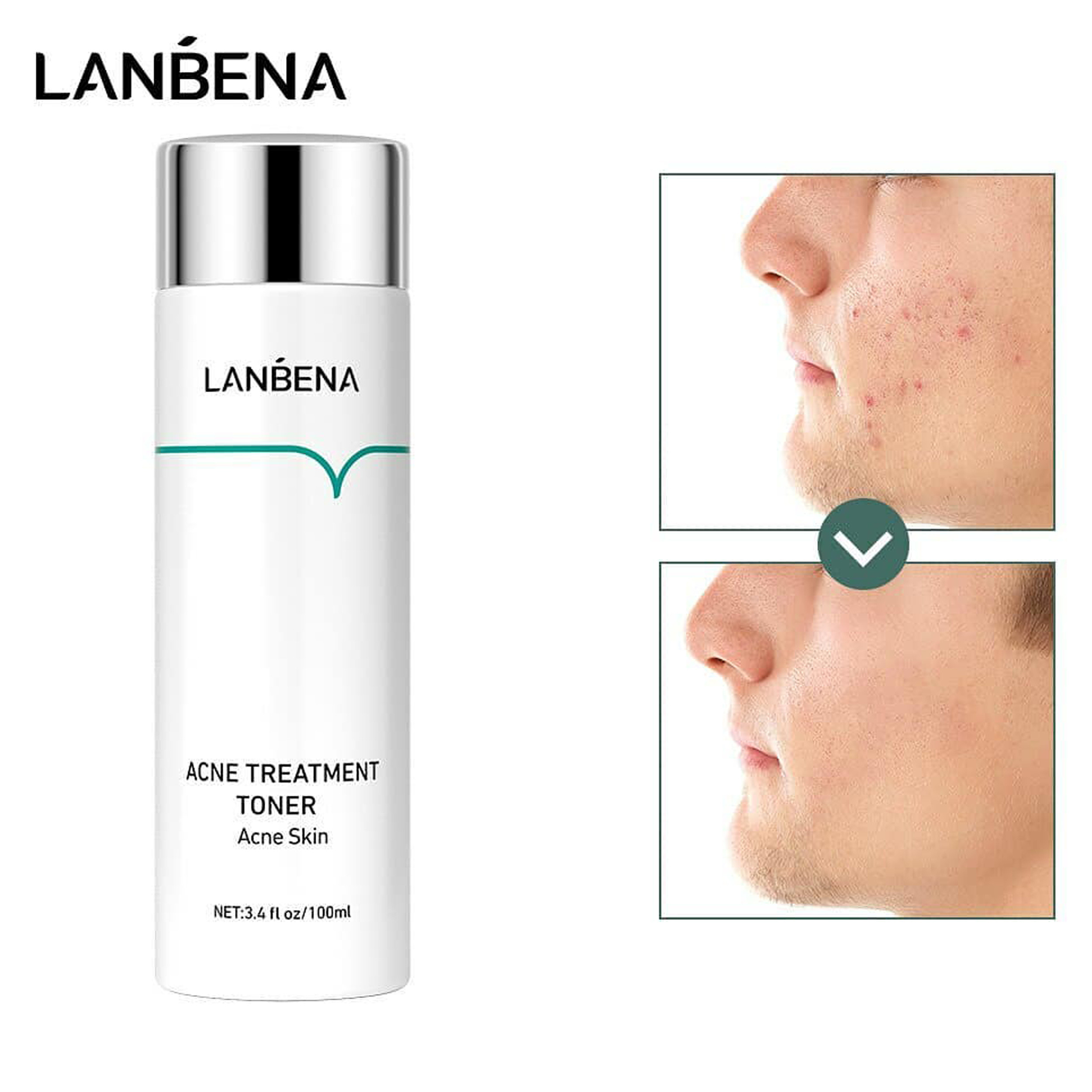 تونر پاک کننده صورت لنبنا مدل ضد جوش حجم 100 میلی لیتر