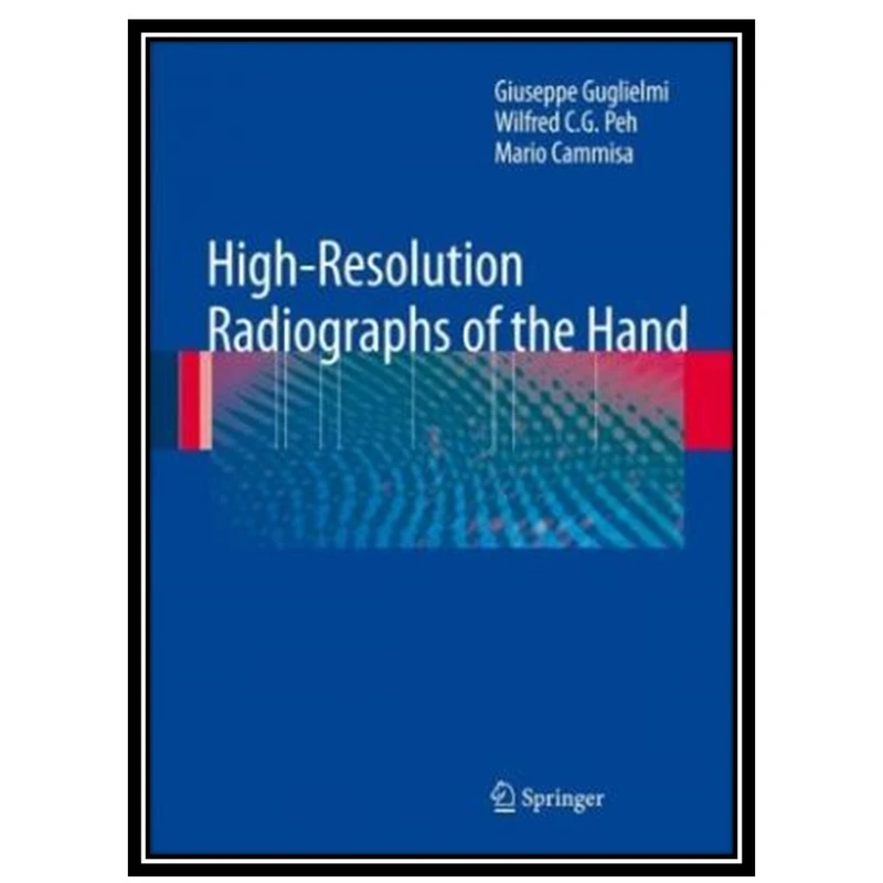 کتاب High-Resolution Radiographs of the Hand اثر جمعی از نویسندگان انتشارات مؤلفین طلایی
