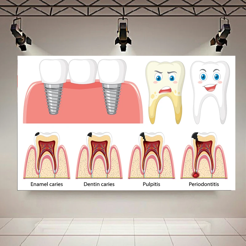 کاغذ دیواری مدل سلامت تا آسیب شدید دندان کد AR305598