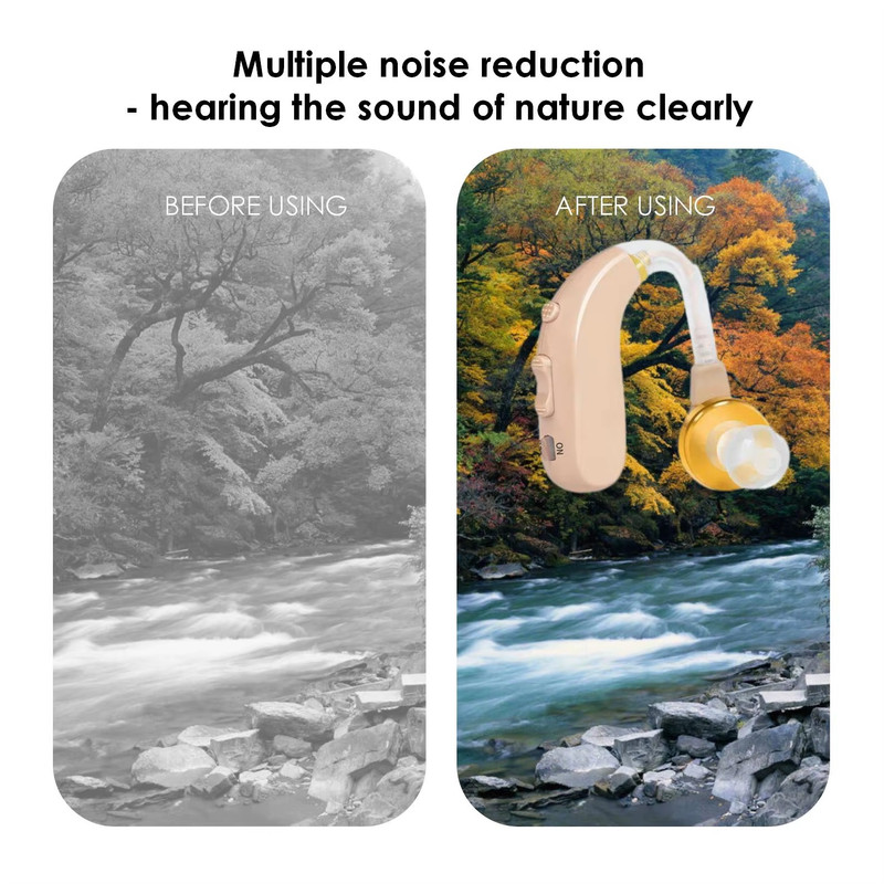 سمعک مدل XB301