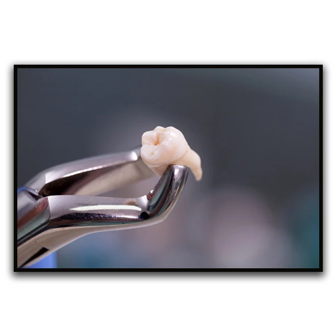 تابلو نوری بکلیت طرح دندانپزشکی مدل B-D1173