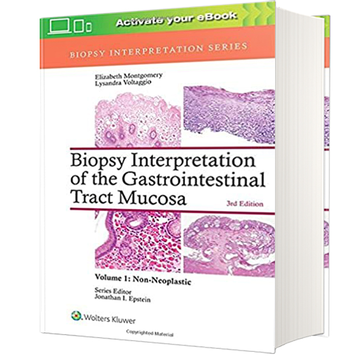 کتاب Biopsy Interpretation of the Gastrointestinal Tract Mucosa: Non-Neoplastic اثر Elizabeth A. Montgomery and Lysandra Voltaggio انتشارات لیپین کات