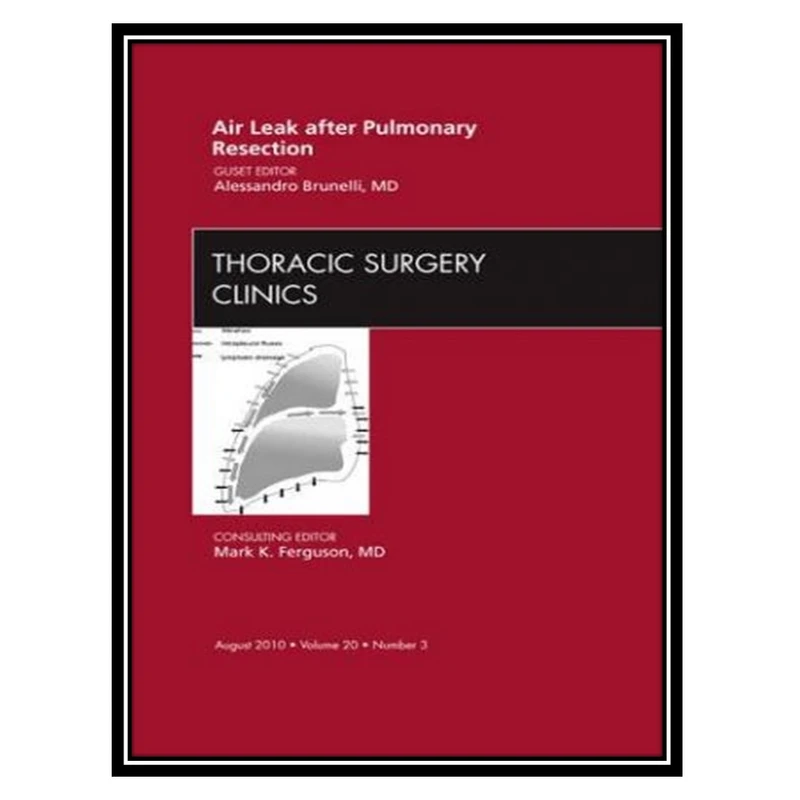 کتاب Air Leak after Pulmonary Resection اثر Alessandro Brunelli MD انتشارات مؤلفین طلایی