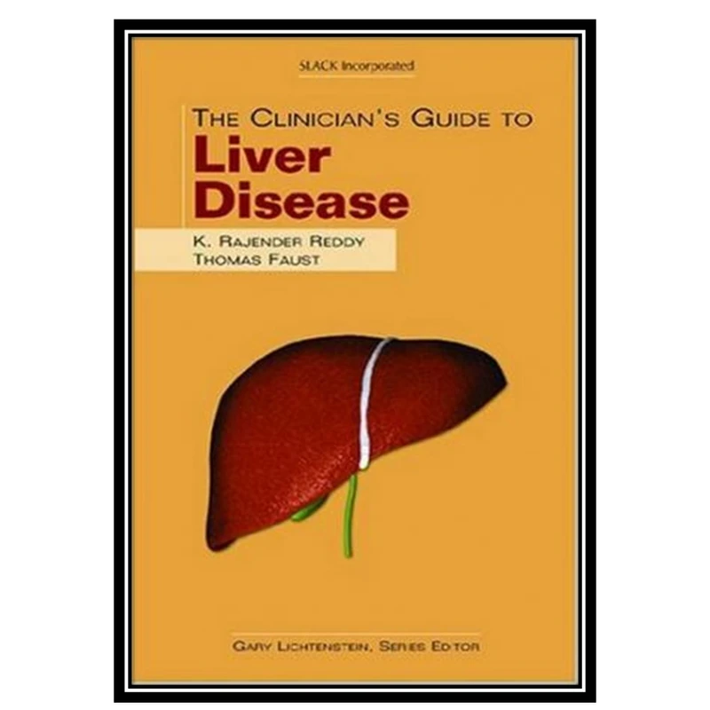 کتاب The Clinicians Guide to Liver Disease اثر K. Rajender Reddy MD and Thomas Faust MD انتشارات مؤلفین طلایی