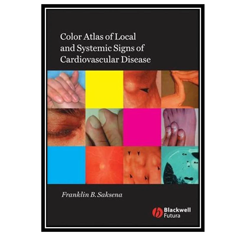 کتاب Color Atlas of Local and Systemic Manifestations of Cardiovascular Disease اثر Franklin B. Saksena انتشارات مؤلفین طلایی