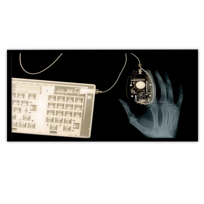 تابلو بکلیت طرح رادیوگرافی دست مدل B-10642