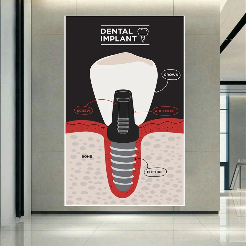 تابلو بوم طرح مخمل آناتومی دندان مدل اینفوگرافیک دندانپزشکی کد AR305516