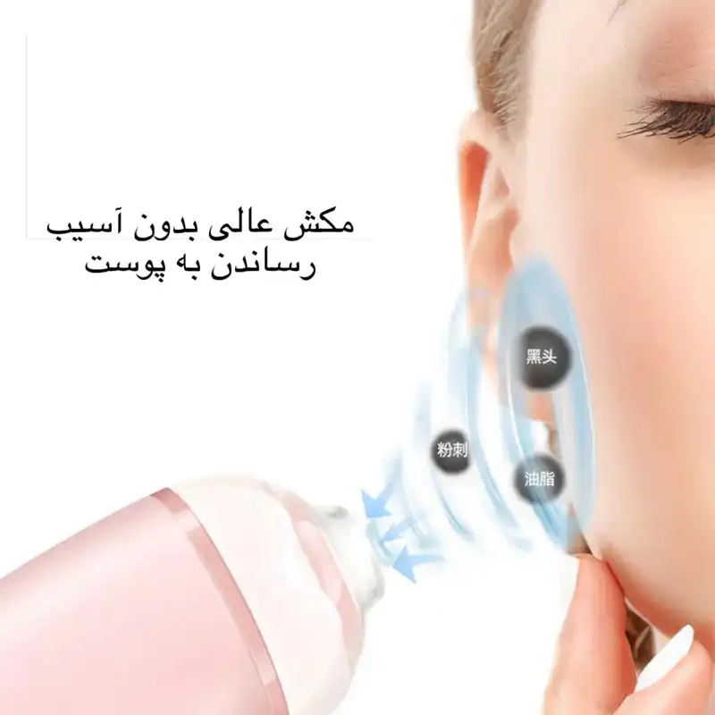 میکرودرم خانگی مدل Acne Blackhead 505
