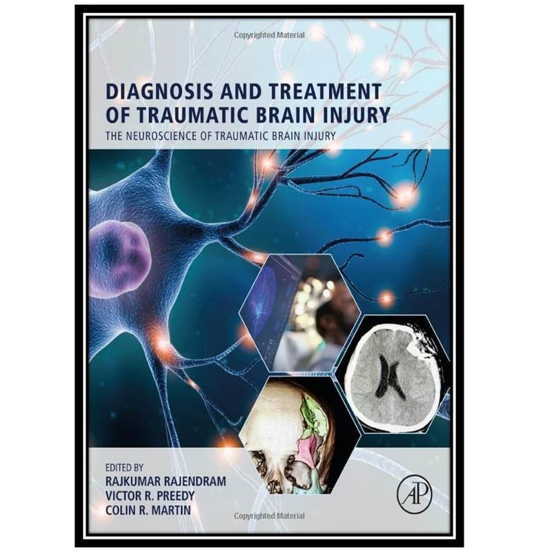 کتاب The Neuroscience of Traumatic Brain Injury, 2 Volume Set اثر جمعی ازنویسندگان انتشارات مؤلفین طلایی