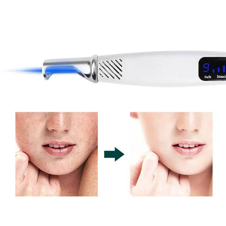 قلم پاک سازی پوست نت سل مدل blue light