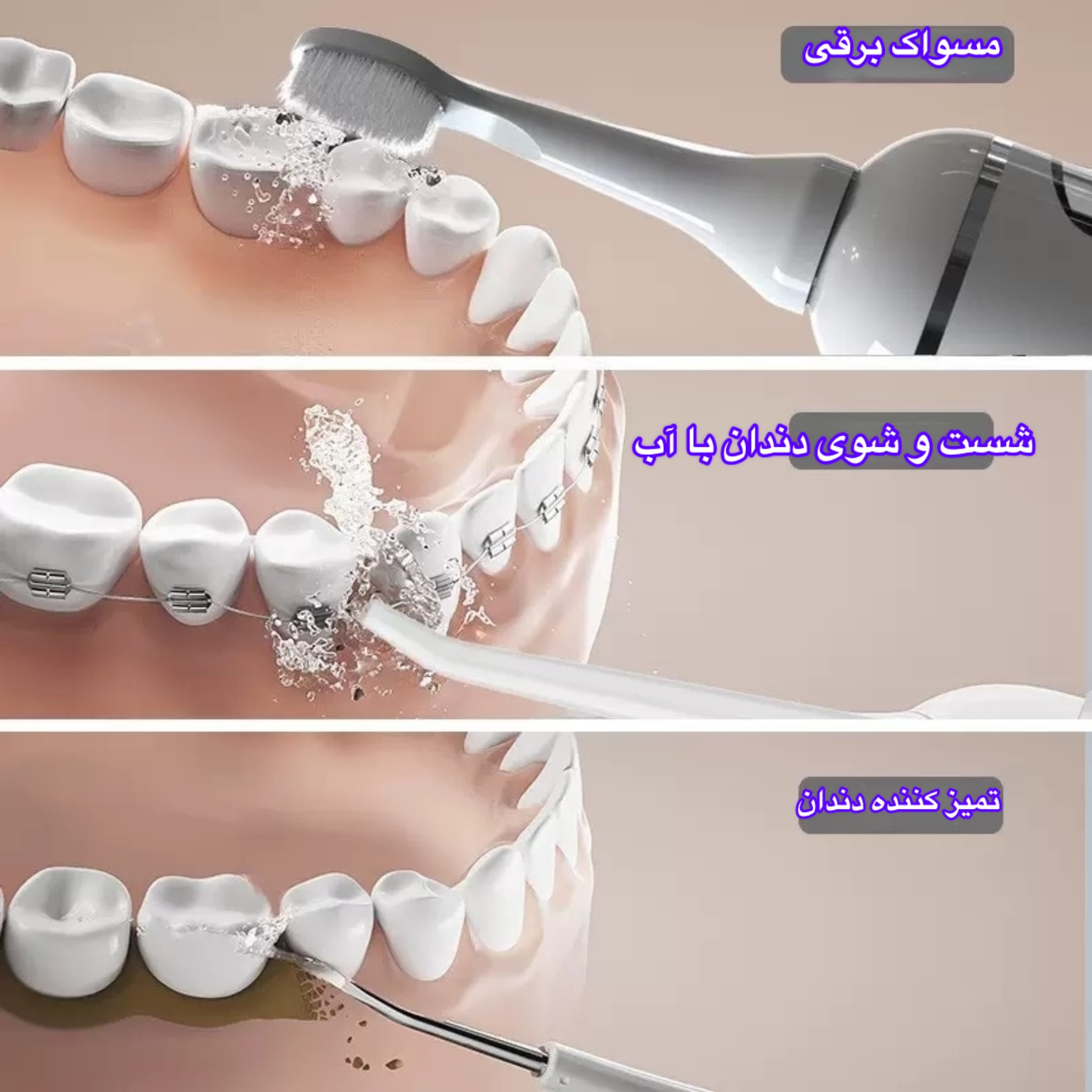 دستگاه شستوشوی دهان و دندان شارژی مدل HF-998 به همراه 6 سری