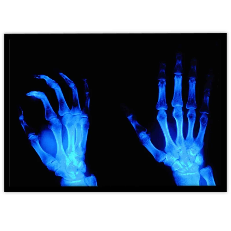 تابلو بکلیت طرح رادیوگرافی دست مدل B-10647