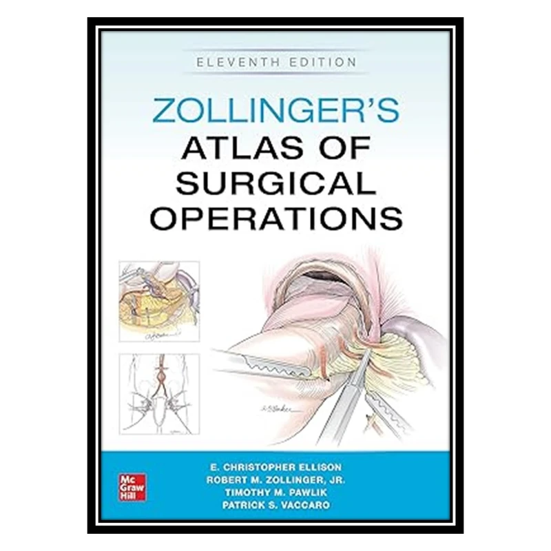 کتاب Zollingers Atlas of Surgical Operations, Eleventh Edition اثر جمعی از نویسندگان انتشارات مؤلفین طلایی