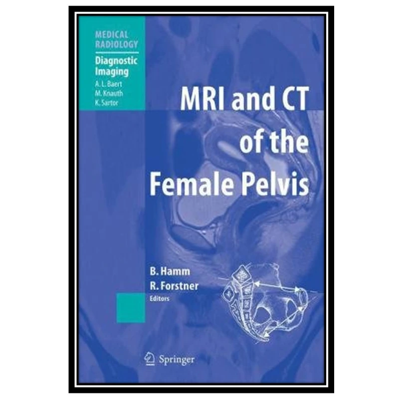 کتاب MR Imaging in White Matter Diseases of the Brain and Spinal Cord اثر جمعی از نویسندگان انتشارات مؤلفین طلایی