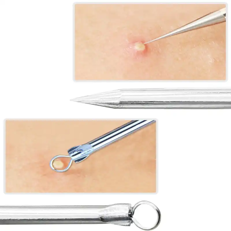 پیلینگ صورت مدل S.12 مجموعه 12 عددی